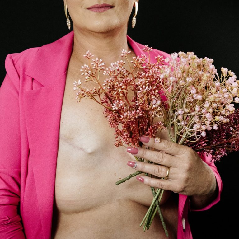Exposição fotográfica retrata mulheres que enfrentam o câncer de mama