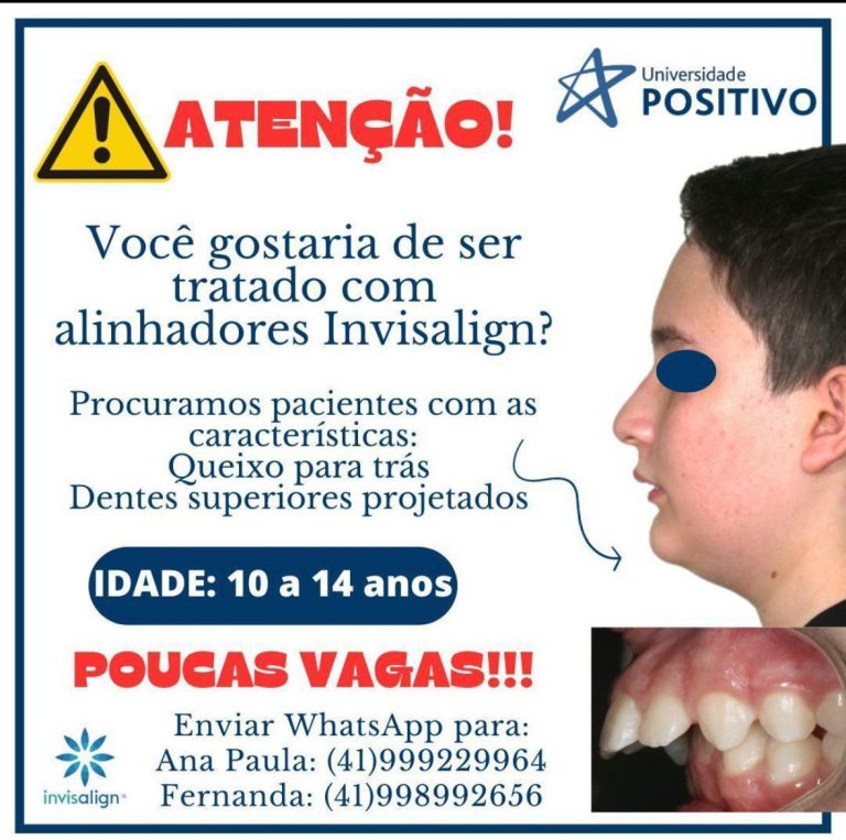 UP tem inscrições abertas para tratamento gratuito com alinhadores Invisalign