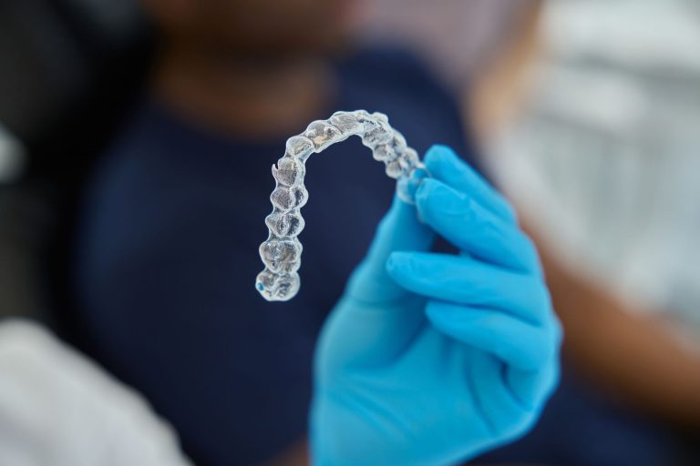Além da estética: estudo revela vantagens dos alinhadores transparentes para a manutenção da saúde bucal durante o tratamento ortodôntico