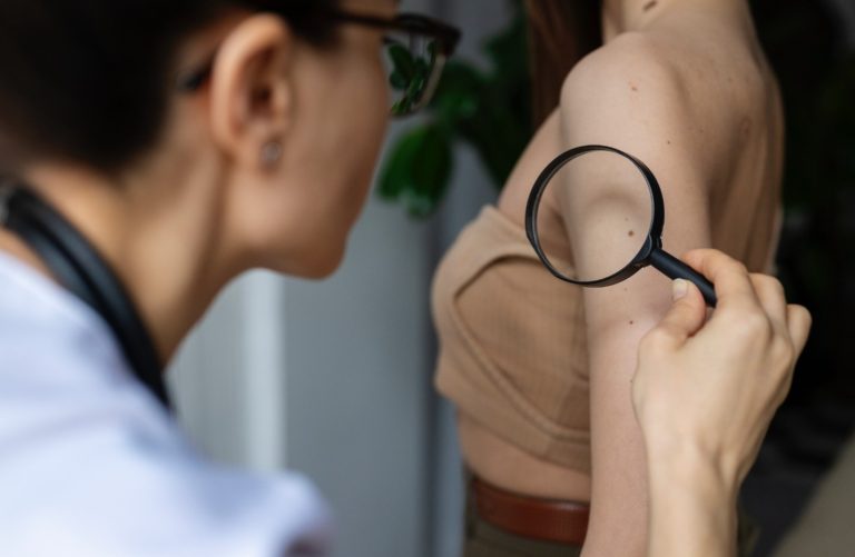 Dezembro Laranja: Paraná segue entre os Estados com maior incidência de câncer de pele