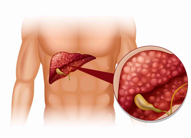 Campanha Julho Amarelo reforça o combate às hepatites virais em todo o país